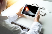 Implications of an Acute Ankle Fracture