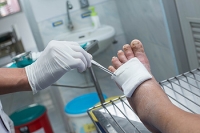 Causes of Foot Infections